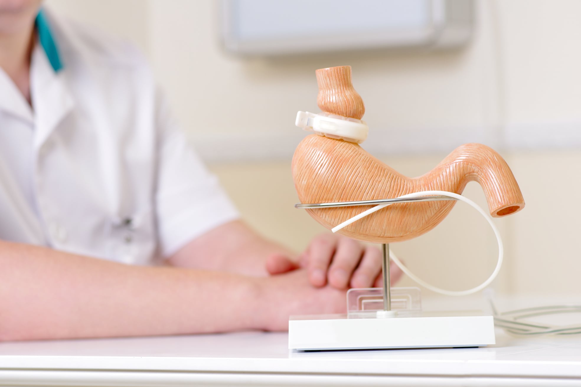 Lap-Band placed on a replica stomach.